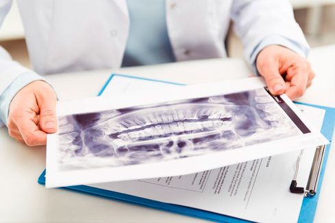 Clínica Dental La Bega profesional revisando radiografía