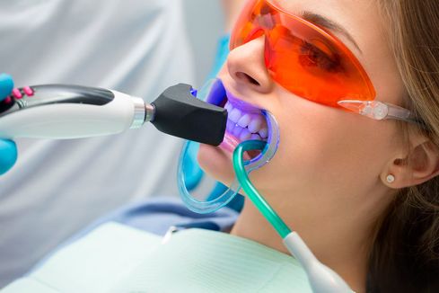 Clínica Dental La Bega persona realizándose blanquimiento dental